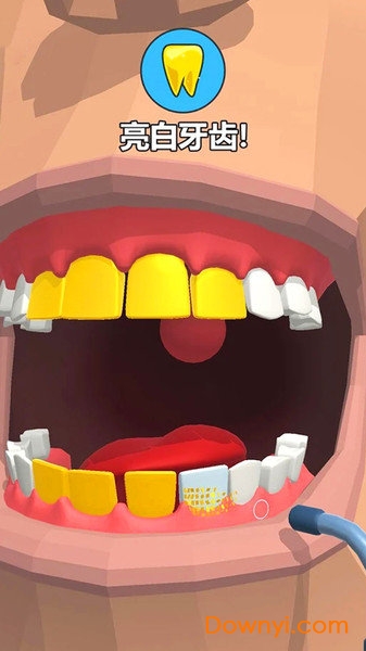 洗牙